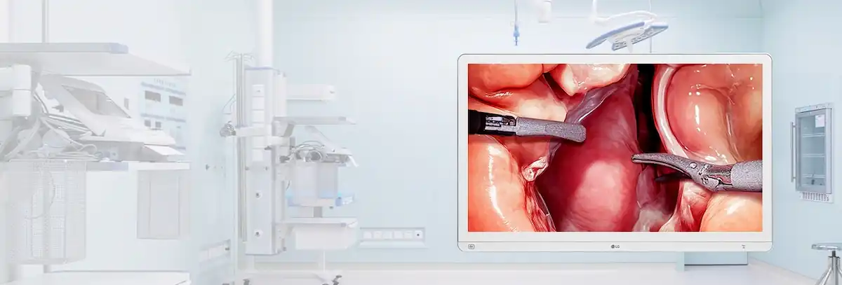 Monitor Cirúrgico LG