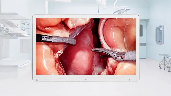 Monitor Cirúrgico LG