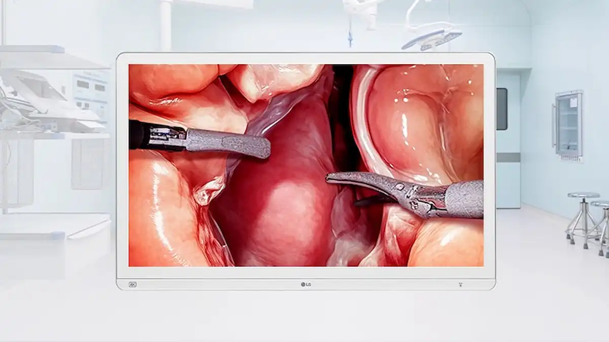 Monitor Cirúrgico LG