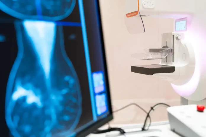 Inteligência Artificial