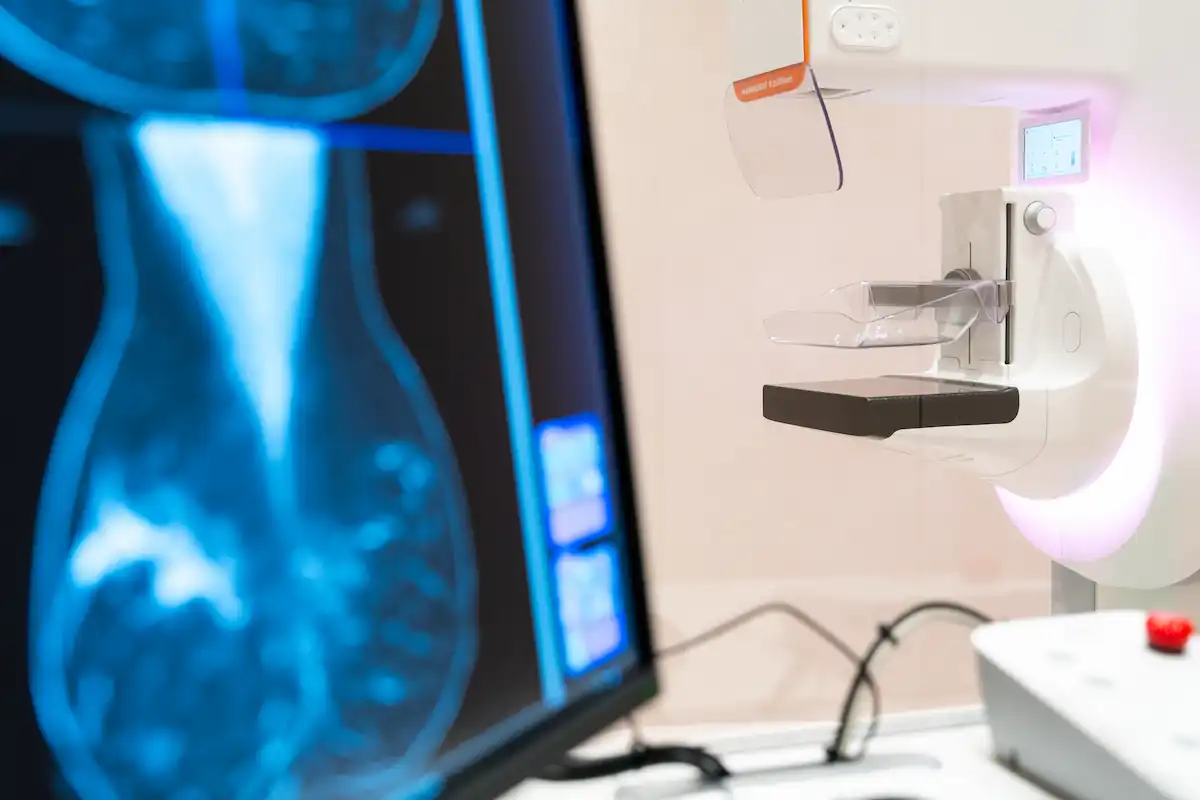 Inteligência Artificial